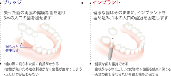 ブリッジとの比較図